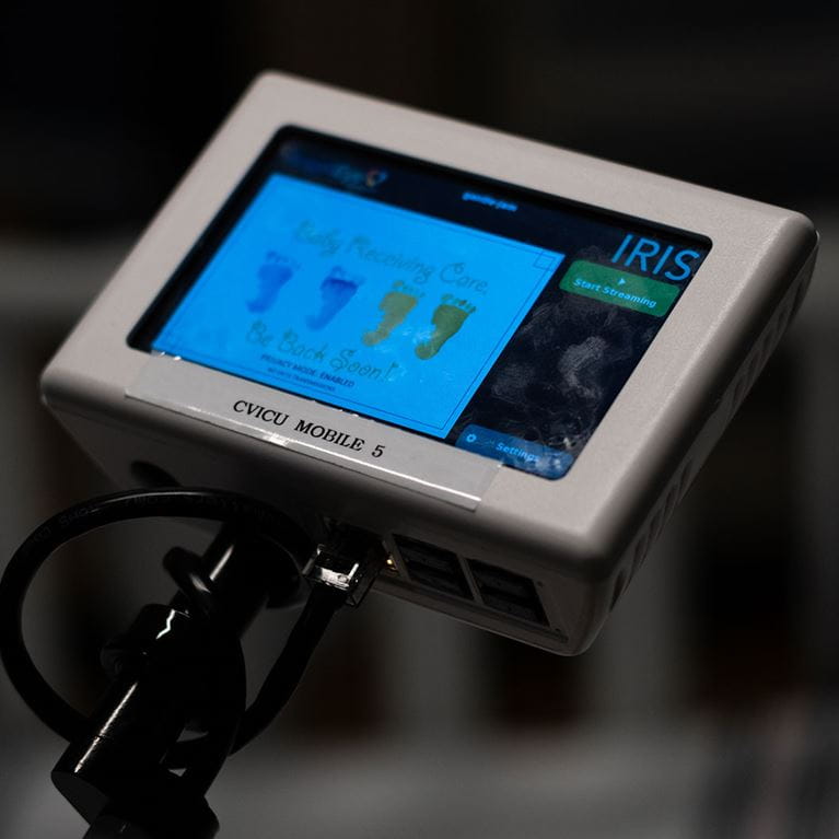 AngelEye Iris Camera.