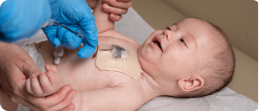 Infant boy laying on clinic bed.